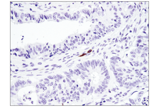 Immunohistochemistry Image 5: TNFRSF8/CD30 (E4L4I) XP® Rabbit mAb