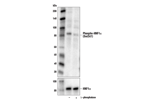 Western Blotting Image 1: Phospho-HNF1α (Ser247) Antibody