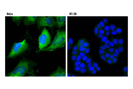 Immunofluorescence Image 1: Fascin (55k-2) Mouse mAb
