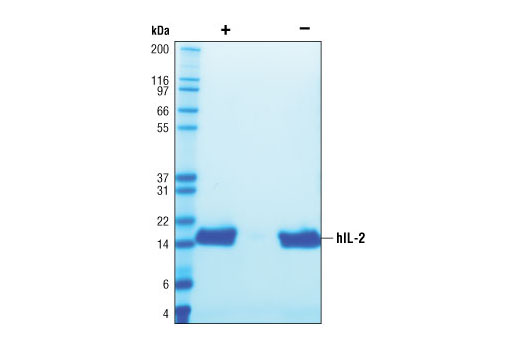  Image 2: Human Interleukin-2 (hIL-2) (mammalian derived)