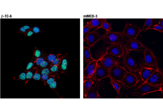 Immunofluorescence Image 1: NKX6.1 (D8O4R) Rabbit mAb