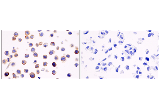 Immunohistochemistry Image 8: DOG1/Anoctamin 1 (K9) Mouse mAb