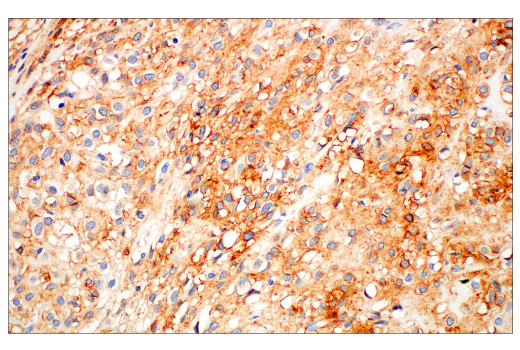 Immunohistochemistry Image 1: DOG1/Anoctamin 1 (K9) Mouse mAb