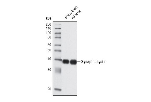 Western Blotting Image 1: Synaptophysin (D35E4) Rabbit mAb