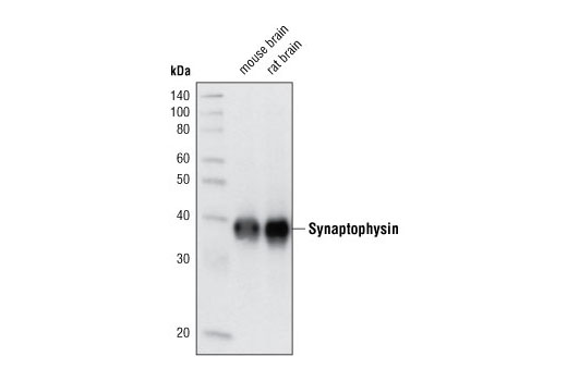 Western Blotting Image 1: Synaptophysin (D40C4) Rabbit mAb