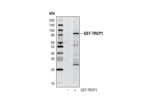 Western Blotting Image 1: GST-Tag (91G1) Rabbit mAb (HRP Conjugate)