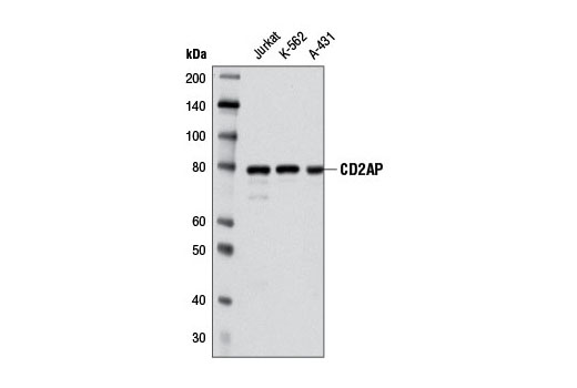 Western Blotting Image 1: CD2AP (A599) Antibody