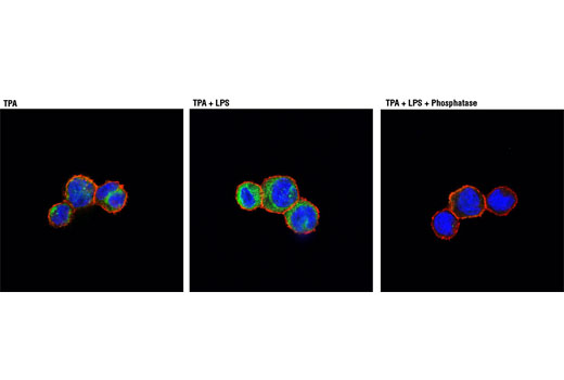 Immunofluorescence Image 1: Phospho-TBK1/NAK (Ser172) (D52C2) XP® Rabbit mAb