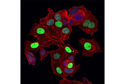 Immunofluorescence Image 1: p21 Waf1/Cip1 (12D1) Rabbit mAb (Alexa Fluor® 488 Conjugate)