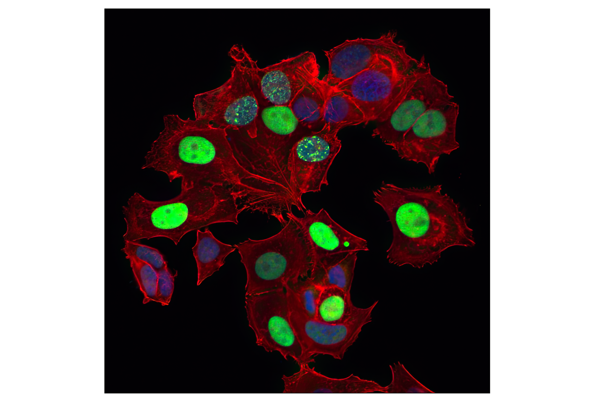 Immunofluorescence Image 1: p21 Waf1/Cip1 (12D1) Rabbit mAb (Alexa Fluor® 488 Conjugate)