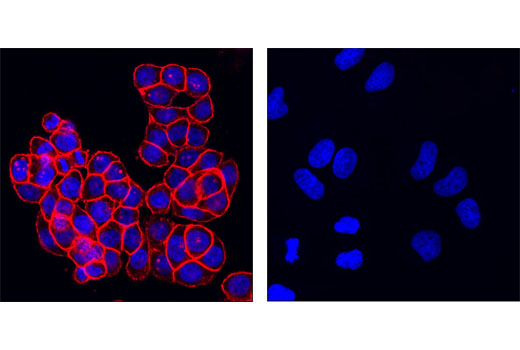 Immunofluorescence Image 1: EpCAM (VU1D9) Mouse mAb (Alexa Fluor® 555 Conjugate)