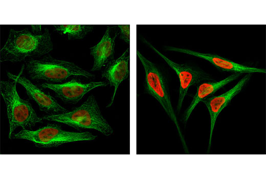 Immunofluorescence Image 1: Acetyl-Histone H3 (Lys9) (C5B11) Rabbit mAb (Alexa Fluor® 555 Conjugate)