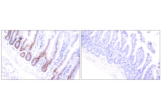 Immunohistochemistry Image 1: Histone H3 (K9M Mutant Specific) (E4N7V) Rabbit mAb