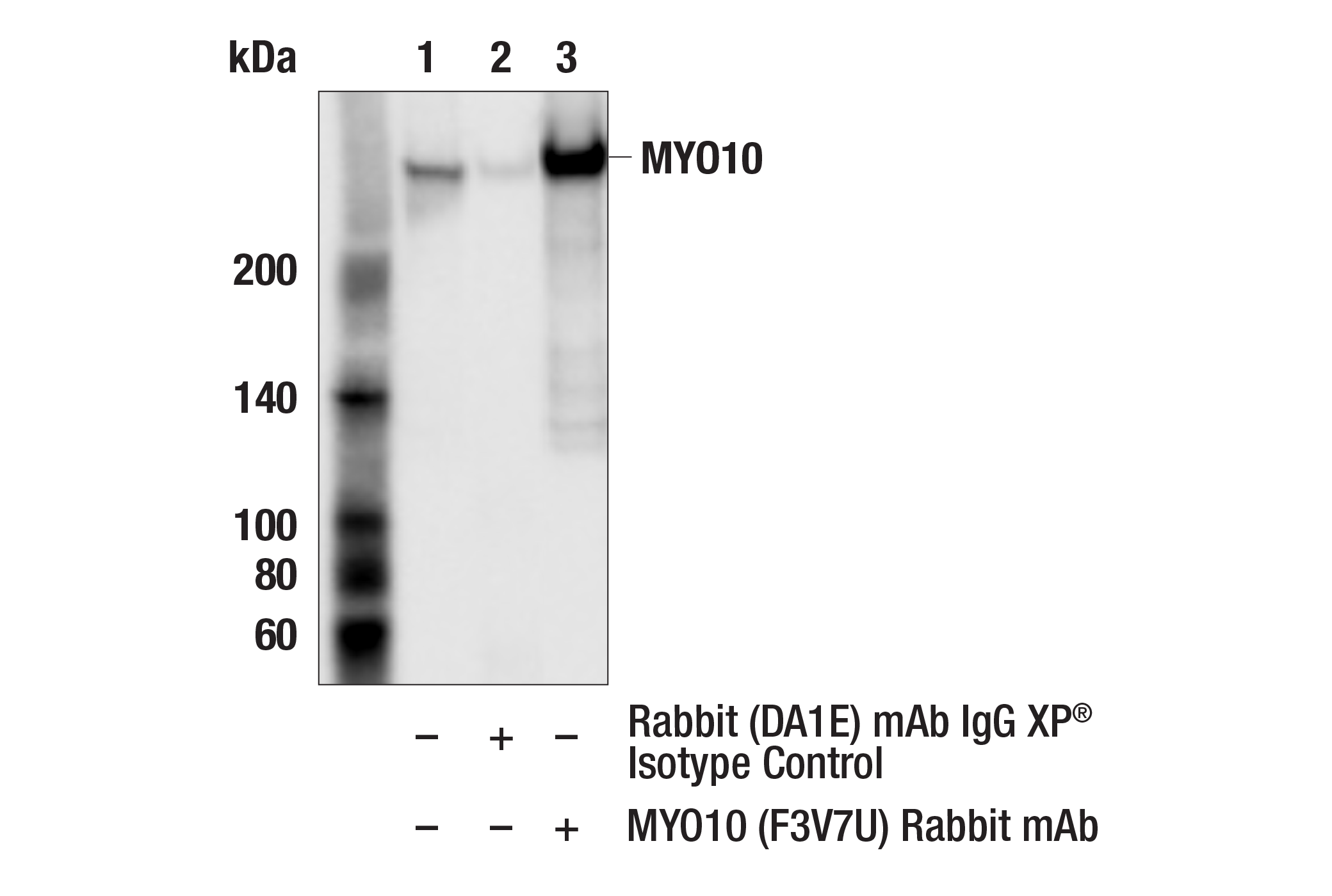 Immunoprecipitation Image 1: MYO10 (F3V7U) Rabbit mAb
