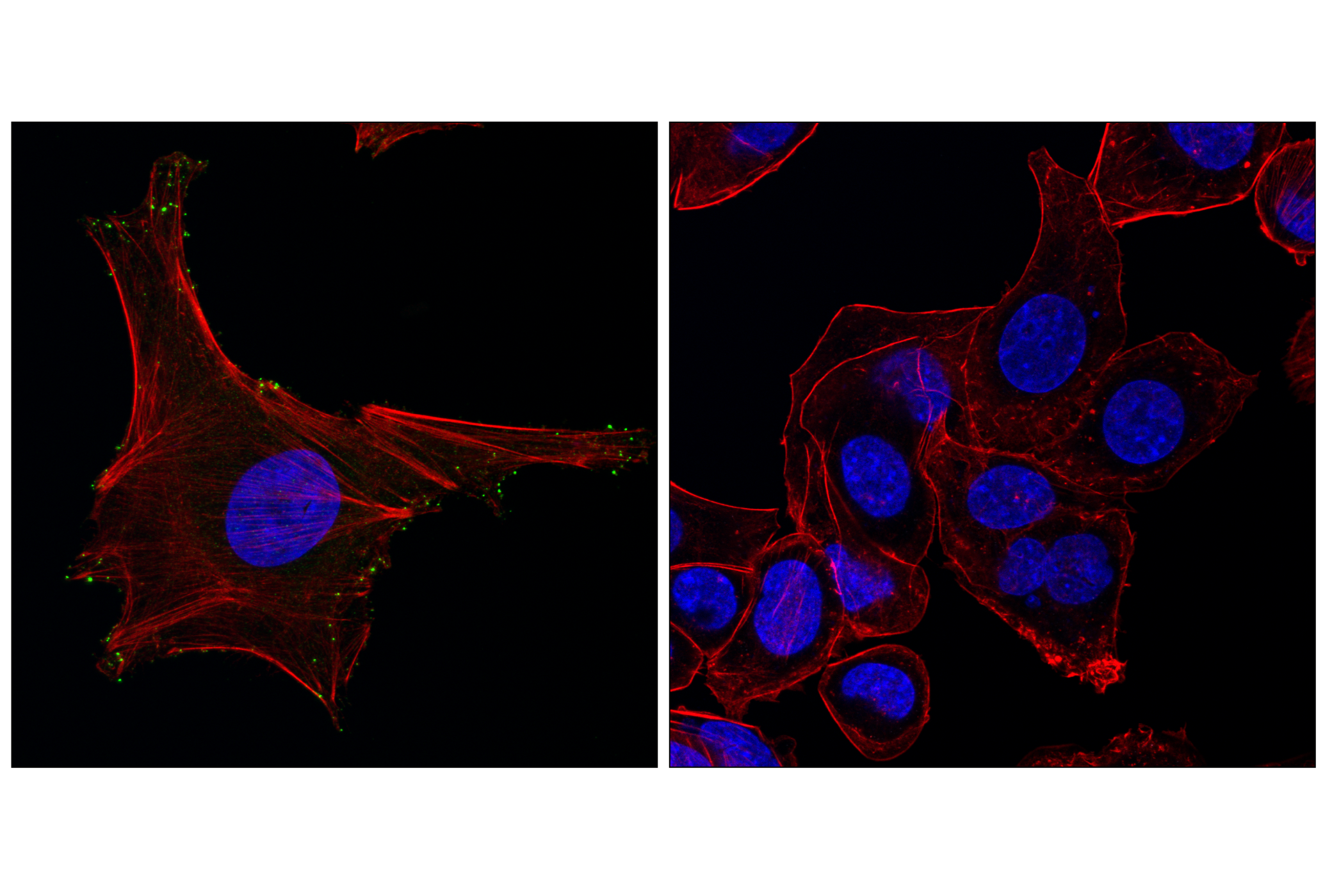 Immunofluorescence Image 1: MYO10 (F3V7U) Rabbit mAb