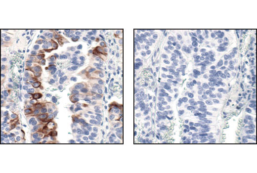 Immunohistochemistry Image 3: Phospho-mTOR (Ser2448) (49F9) Rabbit mAb (BSA and Azide Free)