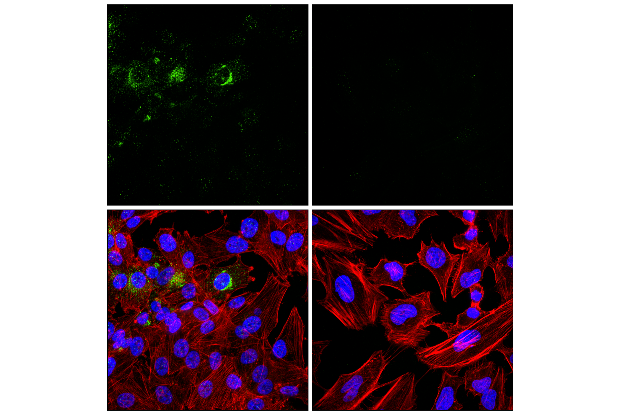 Immunofluorescence Image 1: PTN (F7T3F) Rabbit mAb