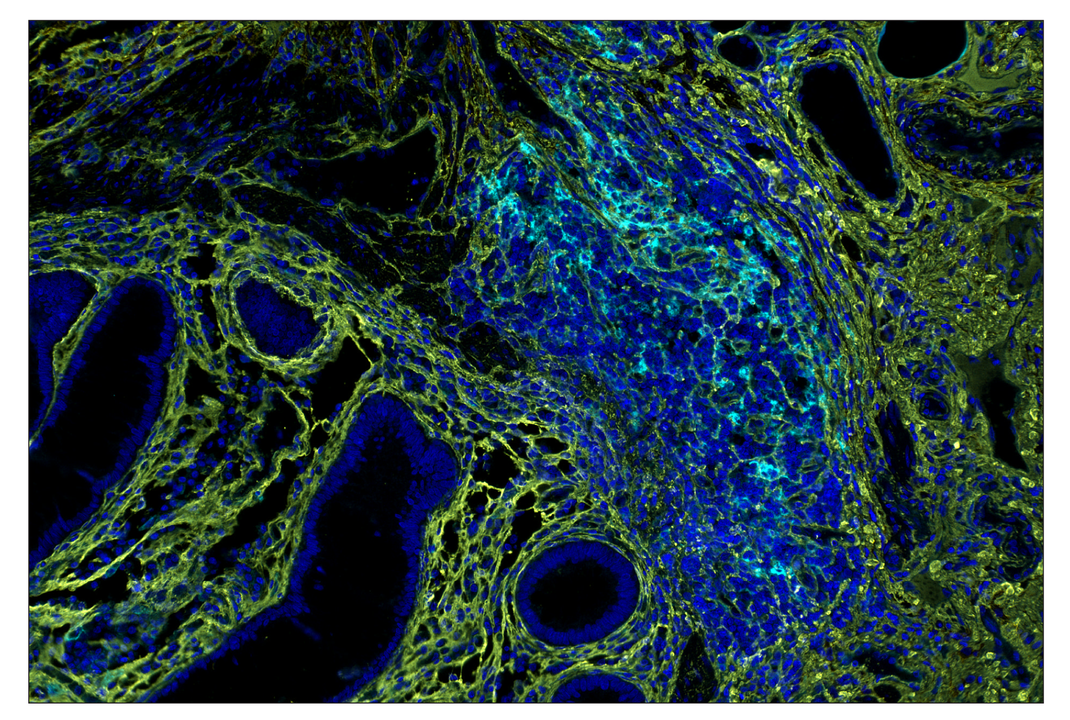 Immunohistochemistry Image 8: CD40 (D8W3N) & CO-0115-594 SignalStar™ Oligo-Antibody Pair