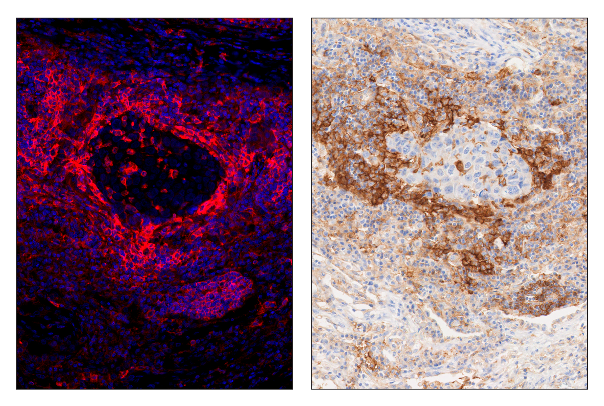 Immunohistochemistry Image 5: CD40 (D8W3N) & CO-0115-594 SignalStar™ Oligo-Antibody Pair