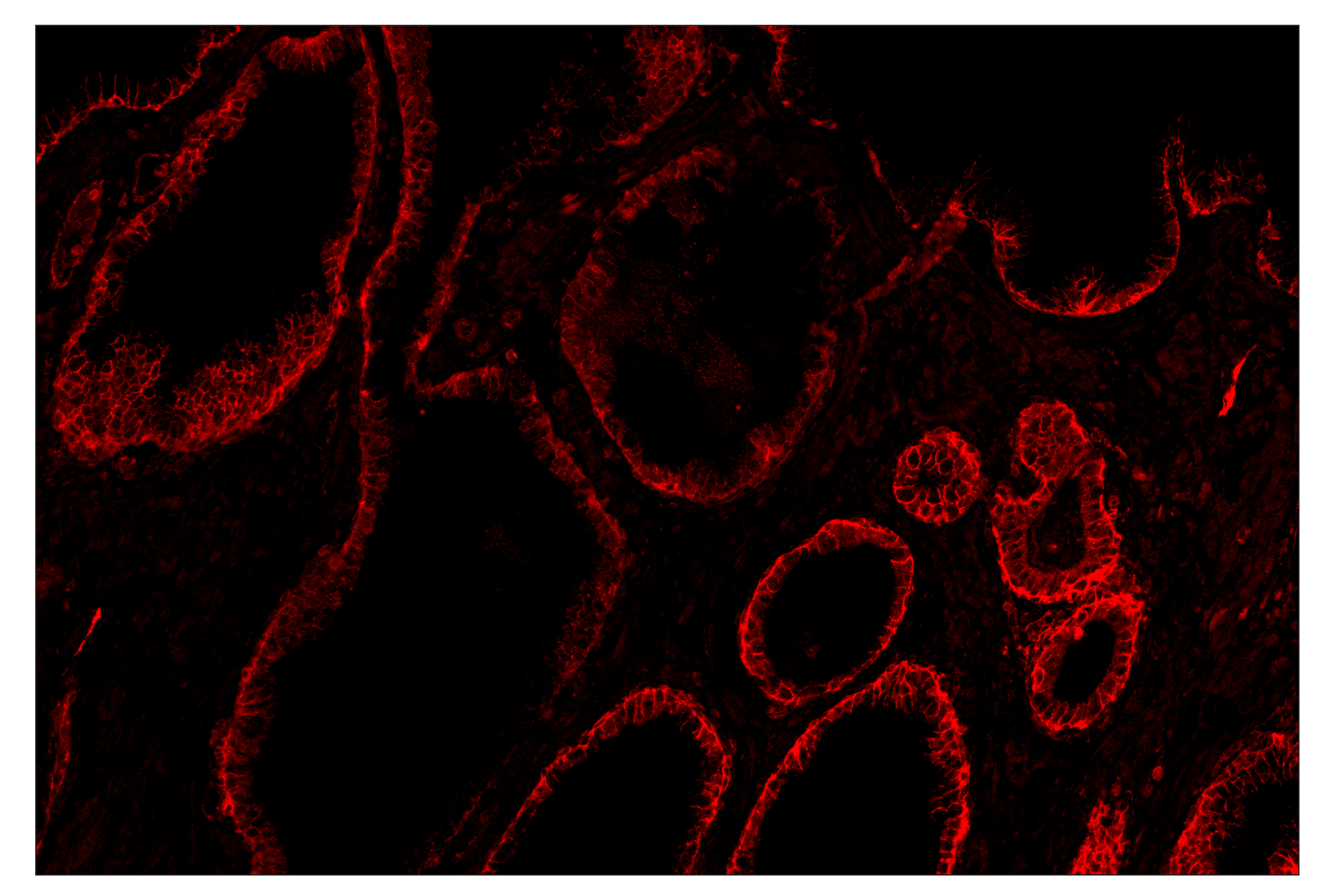 Immunohistochemistry Image 3: CD40 (D8W3N) & CO-0115-488 SignalStar™ Oligo-Antibody Pair