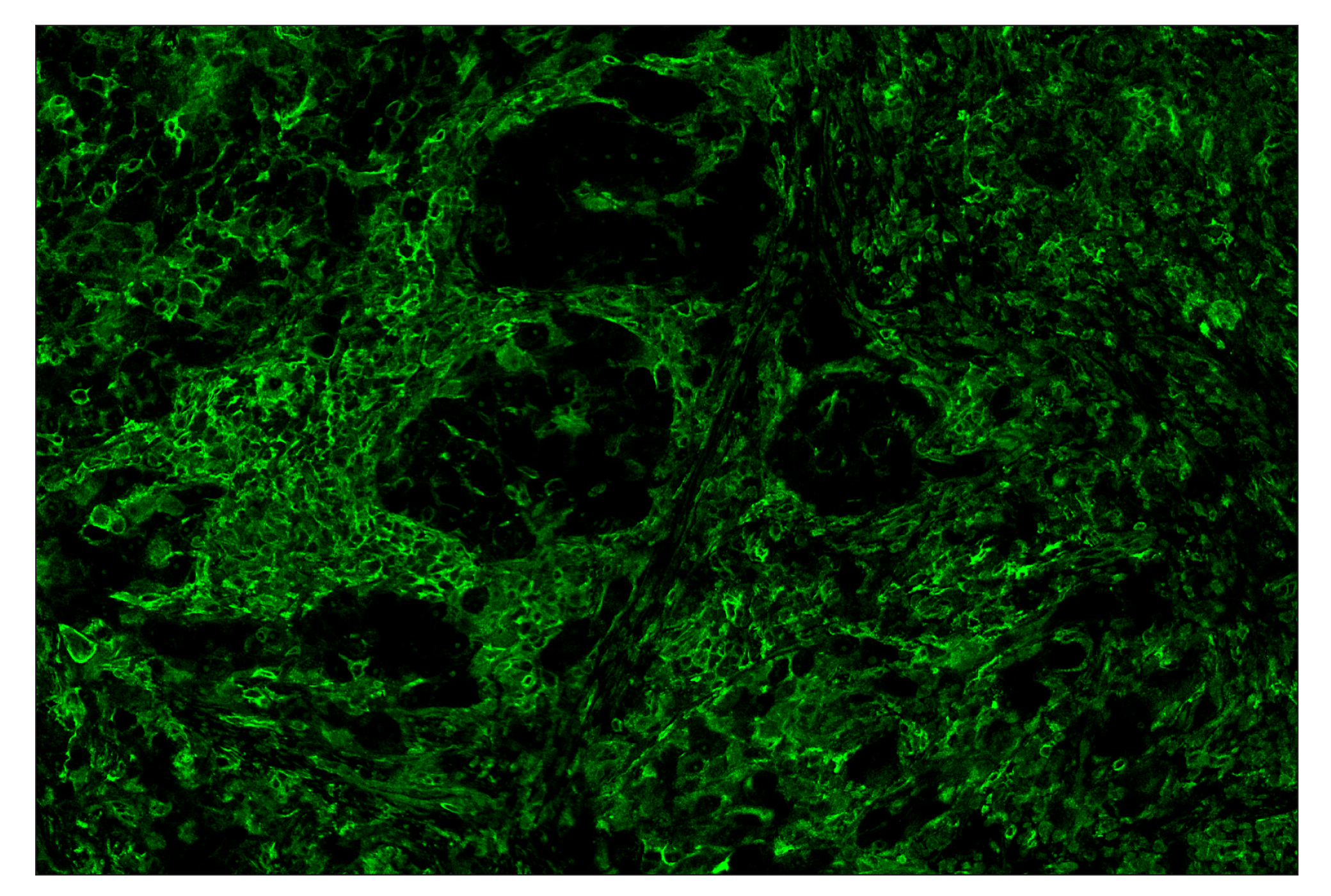 Immunohistochemistry Image 1: CD40 (D8W3N) & CO-0115-594 SignalStar™ Oligo-Antibody Pair