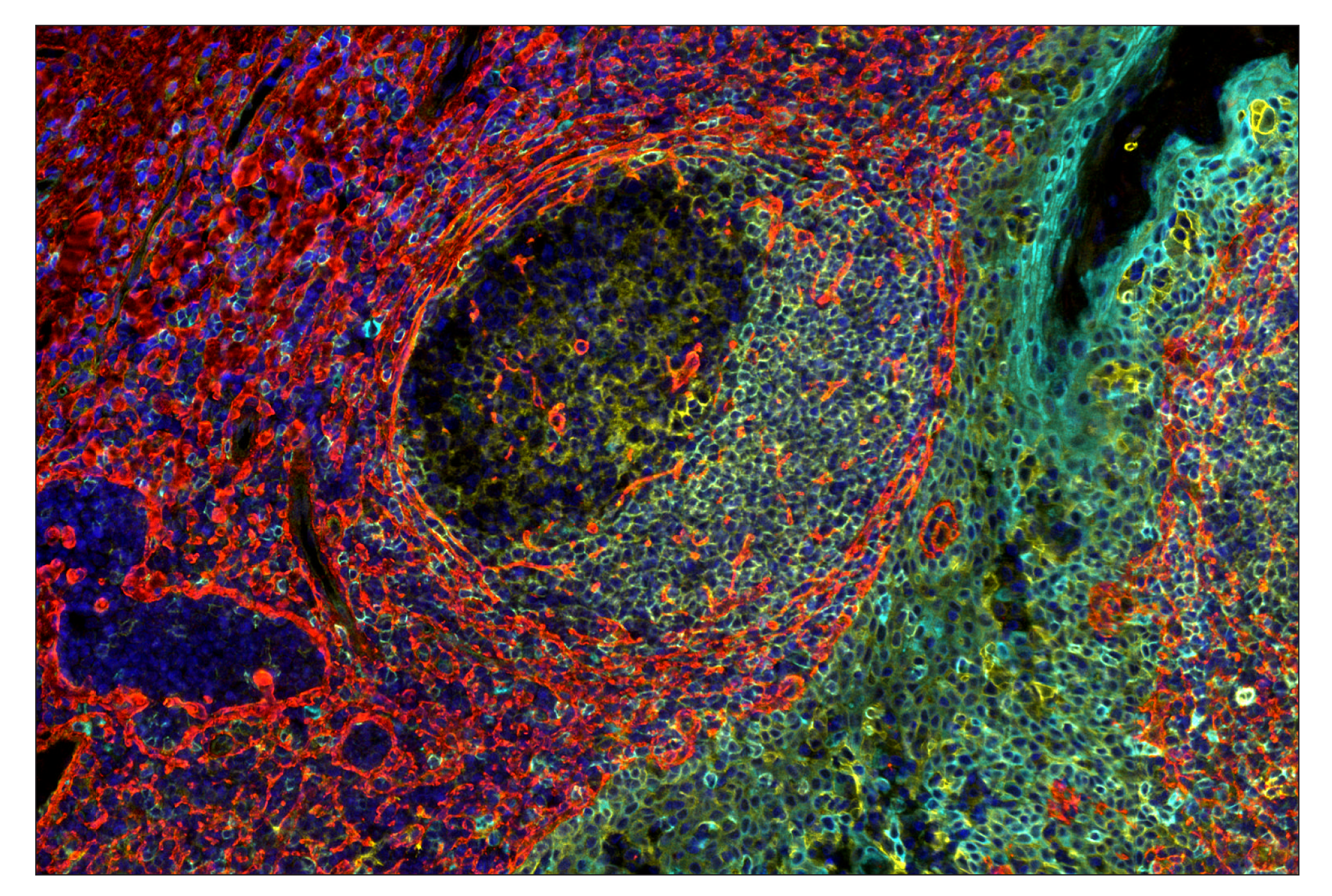 Immunohistochemistry Image 7: CD40 (D8W3N) & CO-0115-750 SignalStar™ Oligo-Antibody Pair