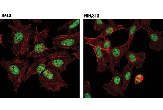 Immunofluorescence Image 1: Tri-Methyl-Histone H3 (Lys27) (C36B11) Rabbit mAb (Alexa Fluor® 488 Conjugate)