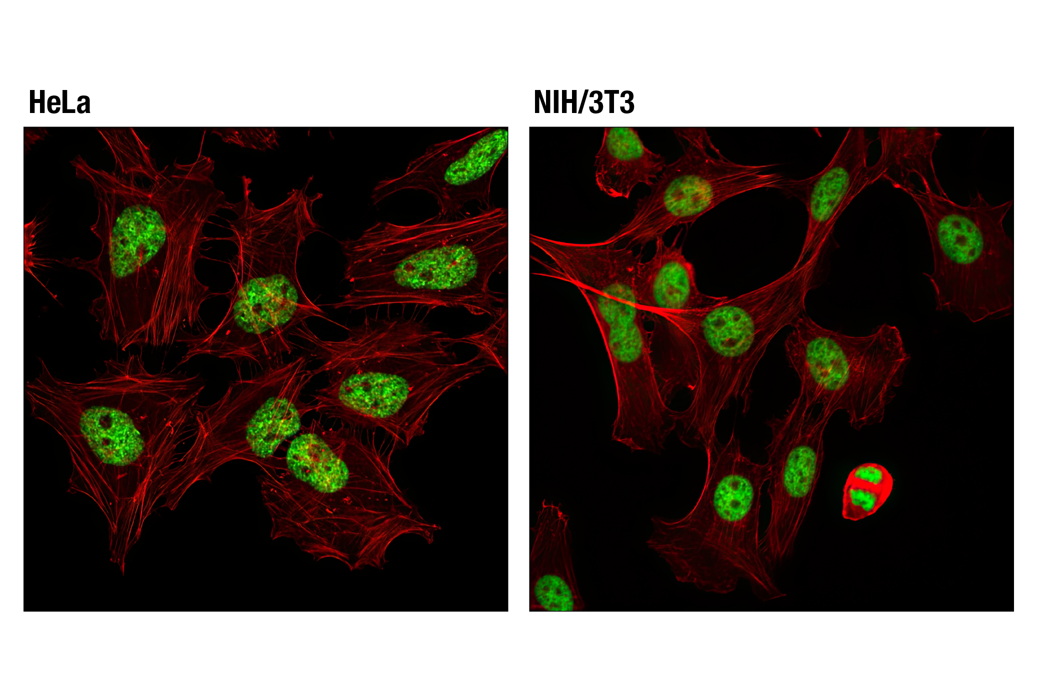 Immunofluorescence Image 1: Tri-Methyl-Histone H3 (Lys27) (C36B11) Rabbit mAb (Alexa Fluor® 488 Conjugate)