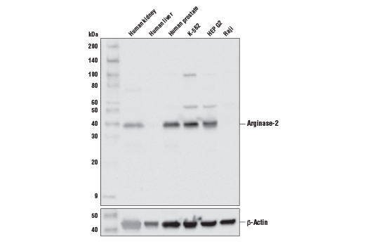 Western Blotting Image 1: Arginase-2 (D9J1N) XP® Rabbit mAb
