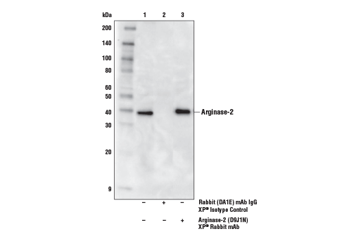 Immunoprecipitation Image 1: Arginase-2 (D9J1N) XP® Rabbit mAb
