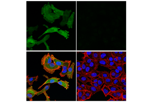 Immunofluorescence Image 1: HSP20 (E6O7A) XP® Rabbit mAb