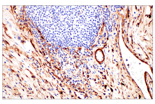 Immunohistochemistry Image 6: HSP20 (E6O7A) XP® Rabbit mAb