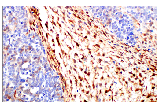 Immunohistochemistry Image 4: HSP20 (E6O7A) XP® Rabbit mAb