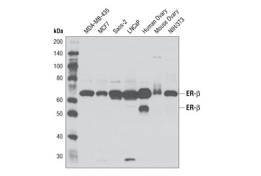 Western Blotting Image 1: Estrogen Receptor β Antibody