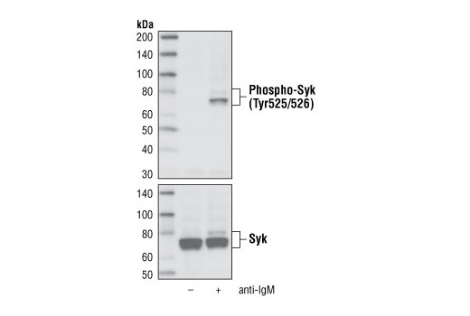 Phospho-Syk (Tyr525/526) (C87C1) Rabbit mAb (Biotinylated Phospho-Syk (Tyr525/526) (C87C1) Rabbit mAb (Biotinylated