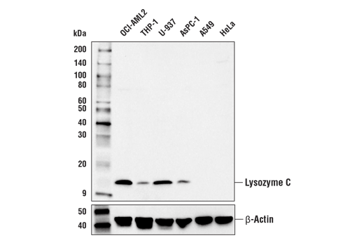 Western Blotting Image 1: Lysozyme C Antibody