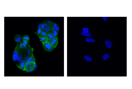 Immunofluorescence Image 1: PTK6/BRK (D4O2D) Rabbit mAb