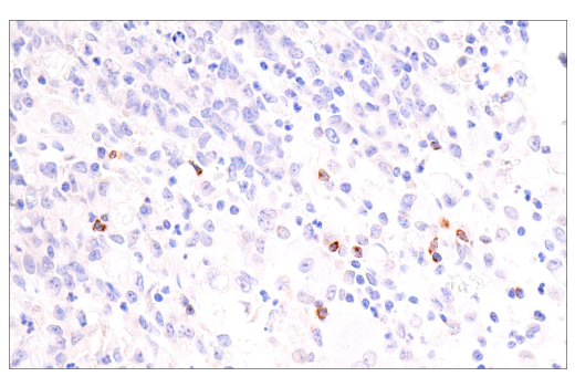 Immunohistochemistry Image 8: CTLA-4 (E2V1Z) Rabbit mAb (BSA and Azide Free)