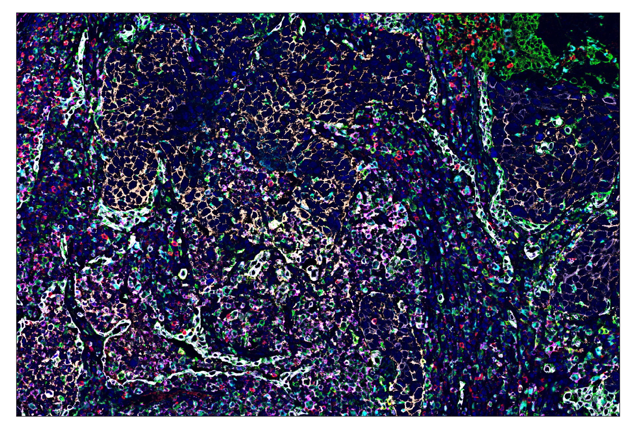 Immunohistochemistry Image 7: HLA-DRA (E9R2Q) & CO-0023-594 SignalStar™ Oligo-Antibody Pair