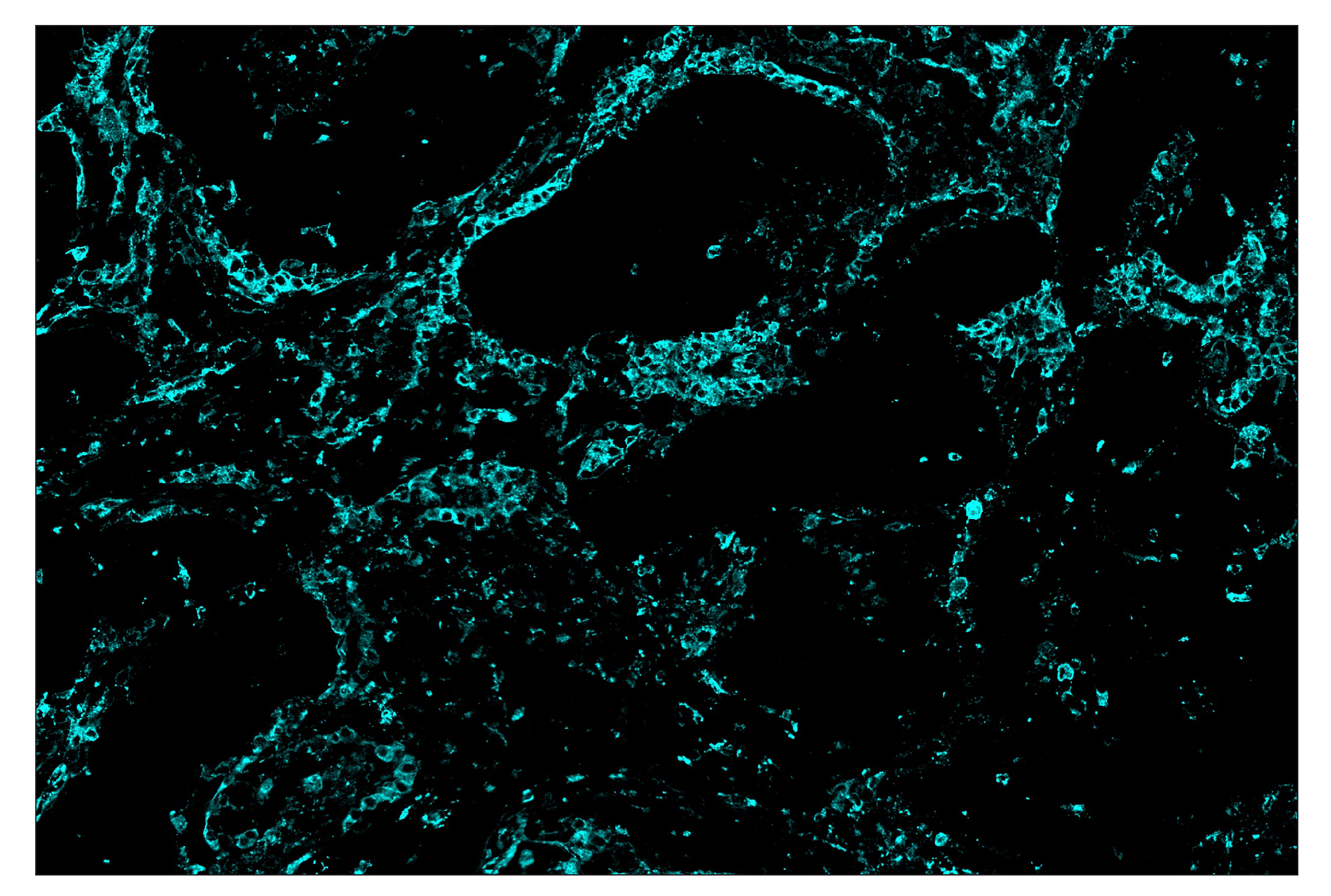 Immunohistochemistry Image 5: HLA-DRA (E9R2Q) & CO-0023-488 SignalStar™ Oligo-Antibody Pair