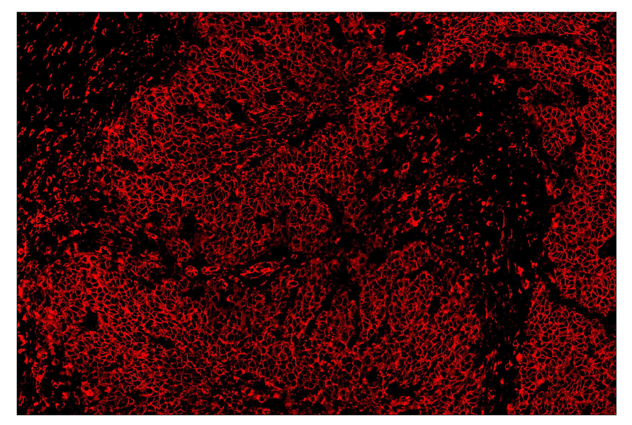 Immunohistochemistry Image 4: HLA-DRA (E9R2Q) & CO-0023-488 SignalStar™ Oligo-Antibody Pair