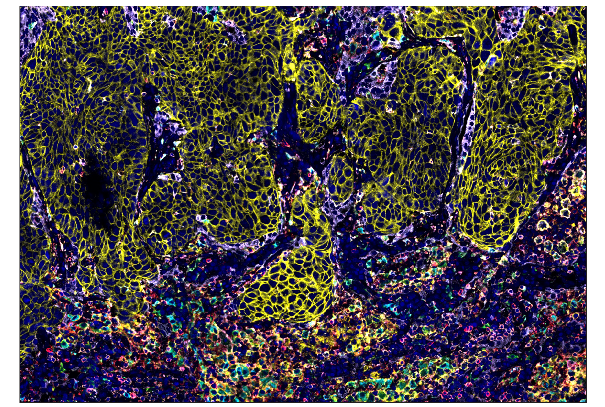 Immunohistochemistry Image 1: HLA-DRA (E9R2Q) & CO-0023-488 SignalStar™ Oligo-Antibody Pair