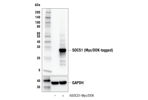  Image 15: Jak/Stat Pathway Inhibitors Antibody Sampler Kit