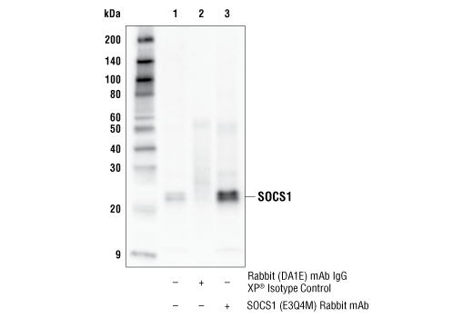 Immunoprecipitation Image 1: SOCS1 (E3Q4M) Rabbit mAb