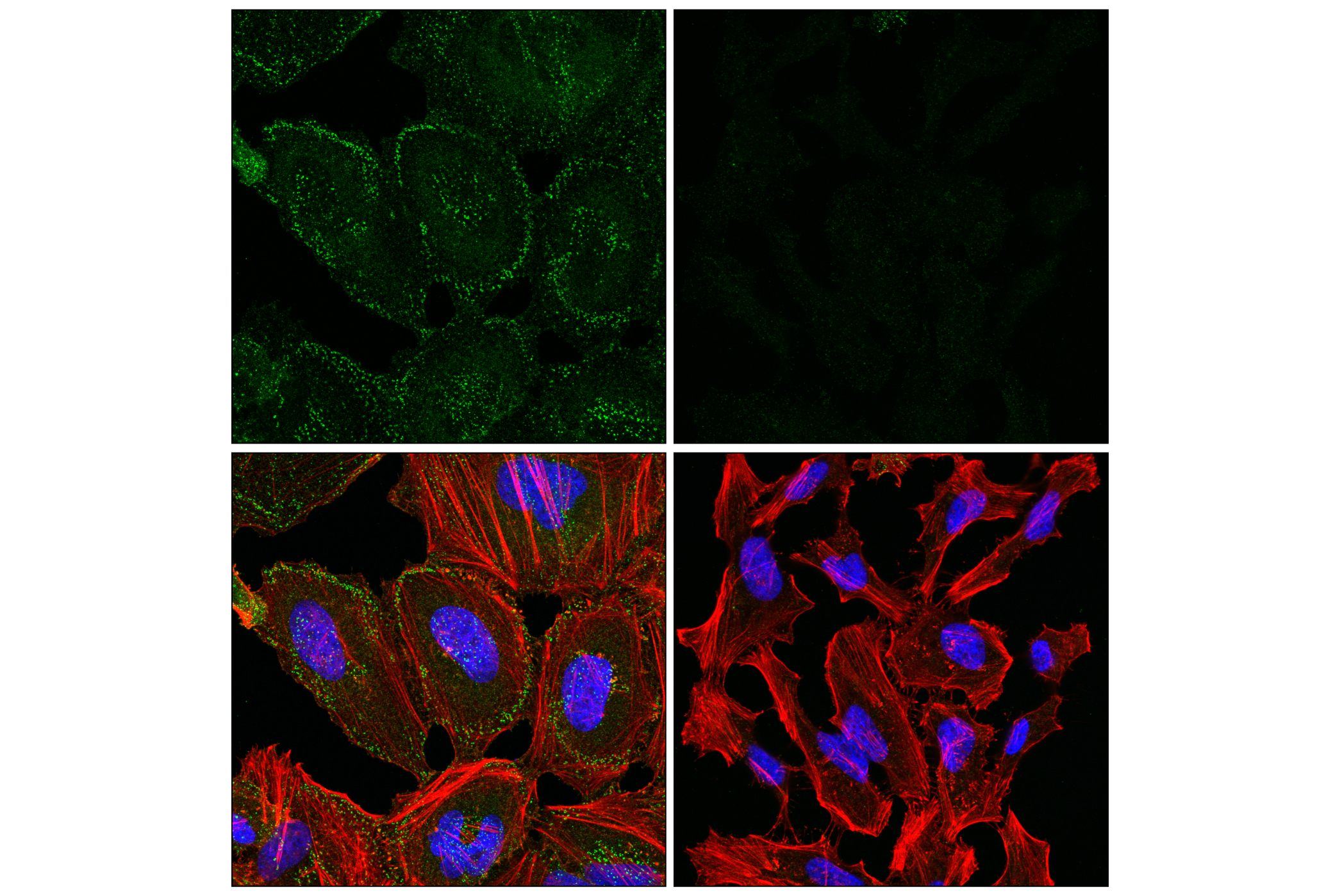 Immunofluorescence Image 1: Numb (F4G6B) Mouse mAb