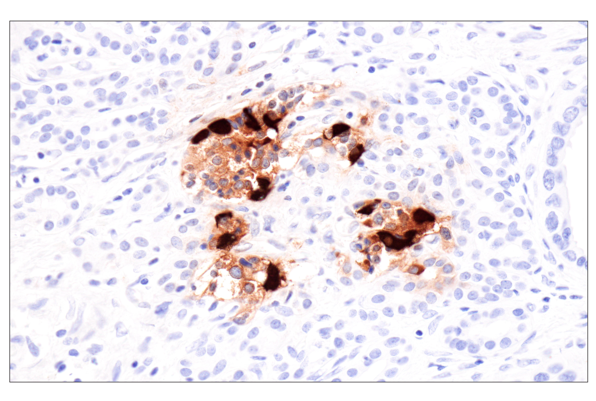 Immunohistochemistry Image 2: Glucagon (F1A2G) Rabbit Monoclonal Antibody