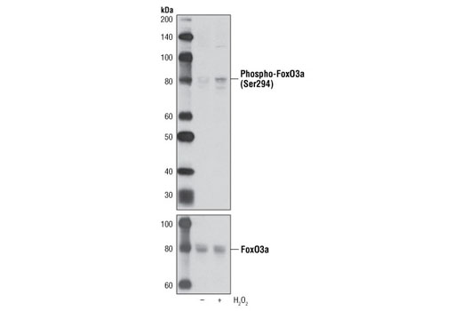 Western Blotting Image 2: Phospho-FoxO3a (Ser294) Antibody