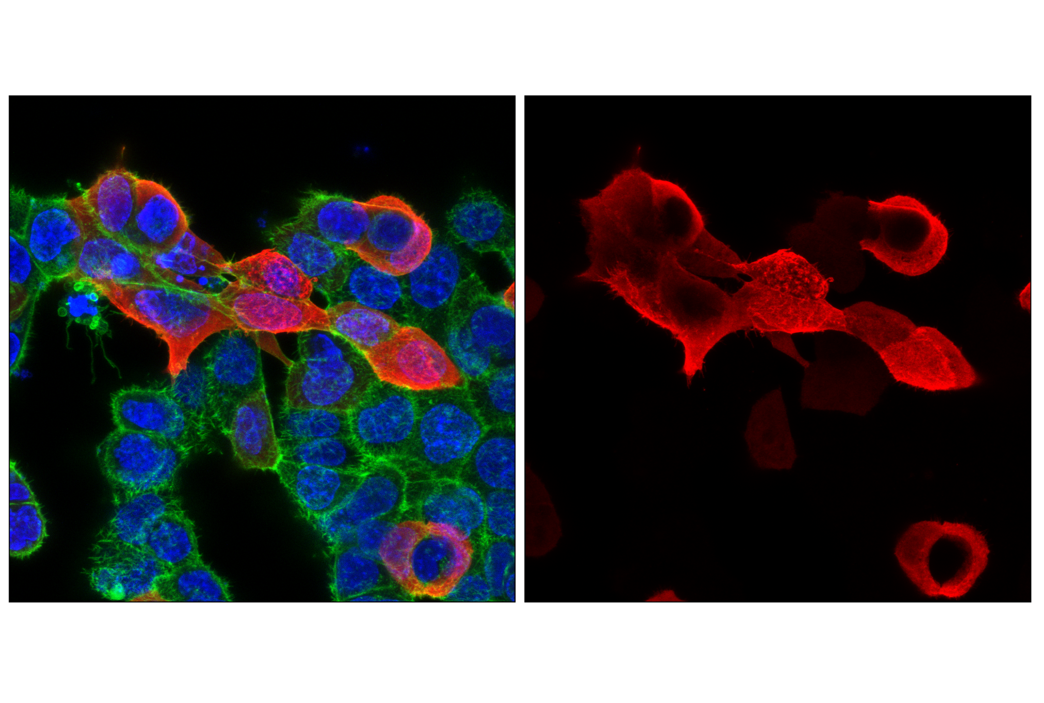 Immunofluorescence Image 1: HA-Tag (C29F4) Rabbit mAb (Alexa Fluor® 555 Conjugate)