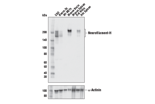 Western Blotting Image 1: Neurofilament-H Antibody