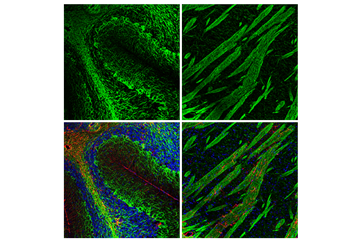 Immunofluorescence Image 1: Neurofilament-H Antibody